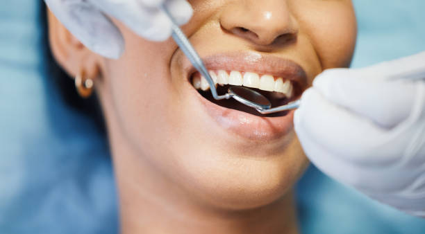Best Knocked-Out Tooth (Avulsed Tooth) Treatment in Demarest, NJ